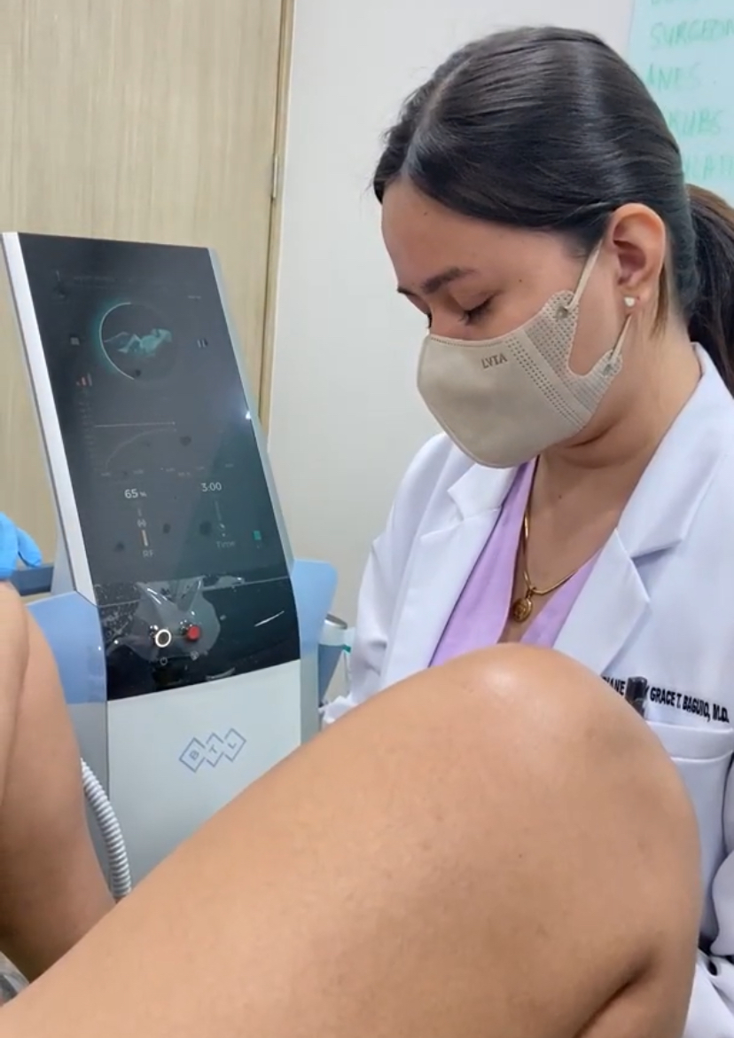 Exion: Vaginal Rejuvenation and Tightening